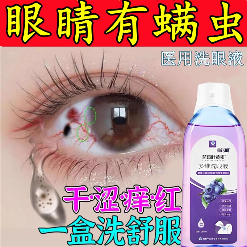极速眼睛除蟎洗j眼液清洁止痒去黄去红血丝蟎虫眼部护理.