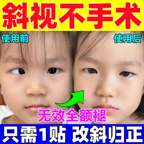 新品斜视矫正器训练器聚散球纠z正儿童成人对眼内外斜视弱视斗鸡