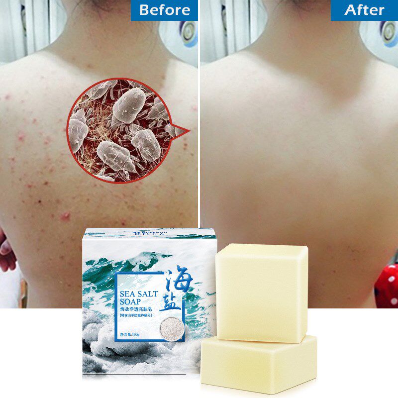 新品Sea Salt Cleaner oil control Anti acne treatment bZody S