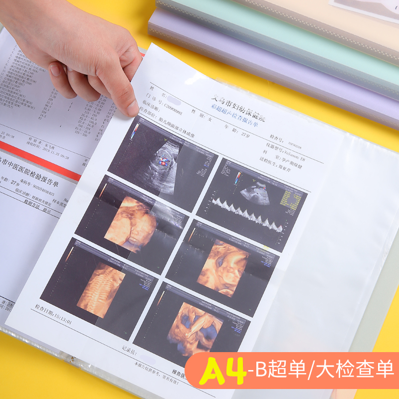 极速孕检收纳册可爱孕妈妈产w检单档案收集册b超资料文件夹活页透