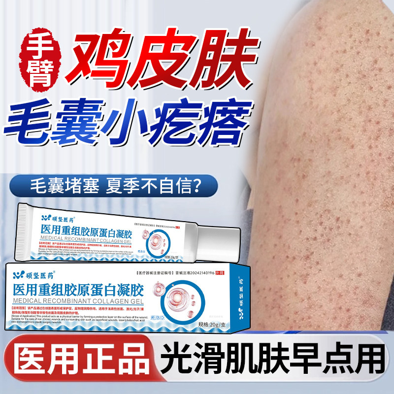 鸡皮肤疙瘩囊角化症儿童手臂毛囊炎专用膏周胳膊上长疙瘩去除毛u9