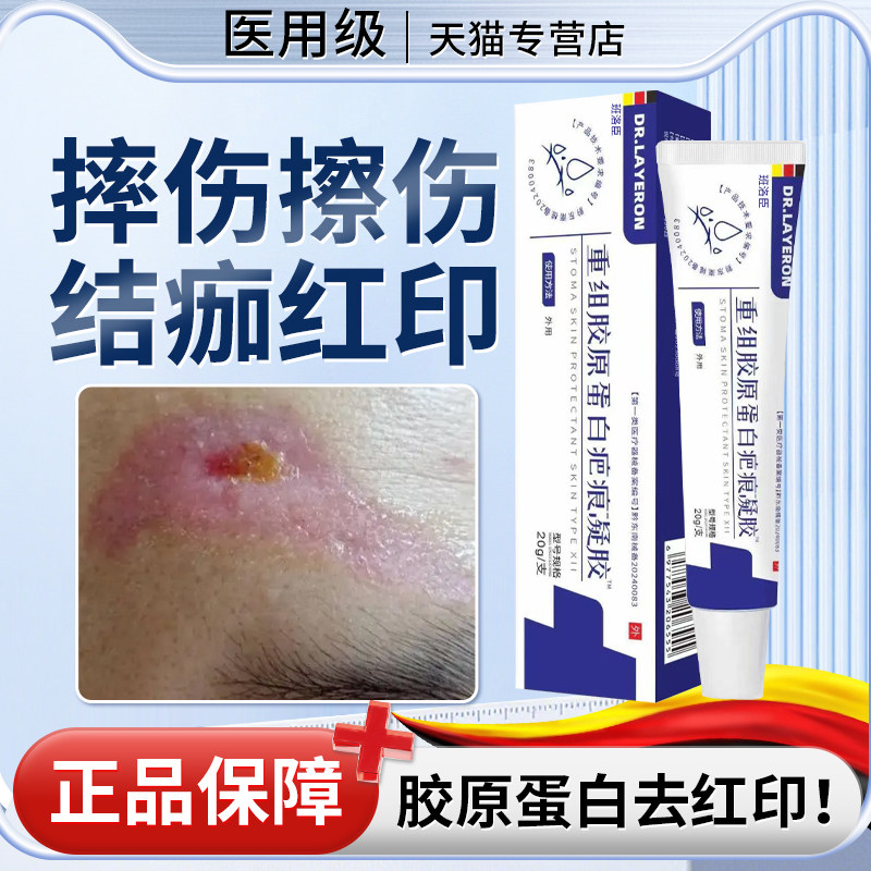 结痂后去红印黑印儿童摔伤擦伤掉痂后除疤痕修复点痣后退红淡印u9图片