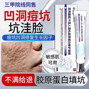 去痘疤痘坑凹洞修复生长因子男士消炎祛痘印淡化膏精华旗舰店T1