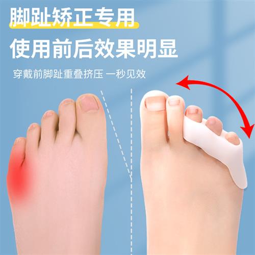 极速小脚趾外翻矫正器分趾器y内翻小拇指去老茧防磨小母脚趾上翘