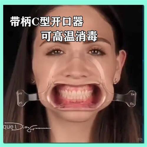 极速嘴巴扩张器口腔支撑器洗牙A嘴巴扩张器撑嘴器张口器撑开嘴巴