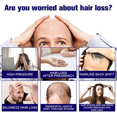 极速Ginger Oil Hair Growth Serum Anti HaiLr Loss Hair Regrow