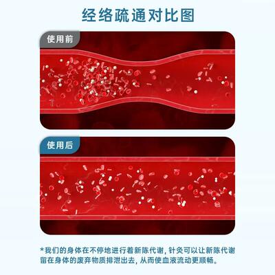 凌远经络笔拨筋棒穴位按摩笔点穴棒器刮痧笔针灸按摩仪家用充电式
