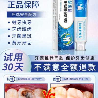 极速补牙神器自己在家补牙齿洞膏补牙缝堵牙洞修复V蛀牙清理龋齿
