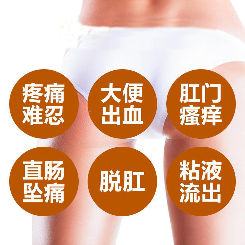 极速血结康之轻祛肉n球黄河人草本痔疮凝胶内外痣洁娘子消痔膏去