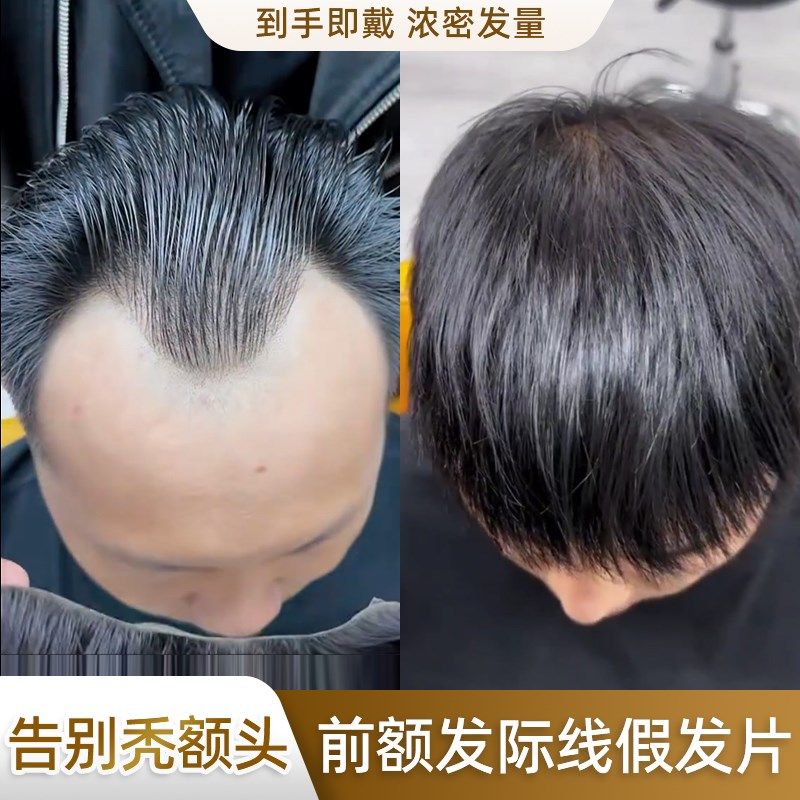 极速发际线贴男m型假刘海假发男生男款假L发贴男士假发片无痕隐形