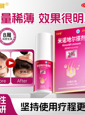 【万必健】米诺地尔搽剂2%*60ml*1瓶/盒【国货老牌】NO.1