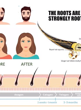 极速Hair growth spray nourisheAs hair roots, protects hair 5