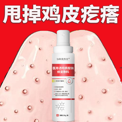 祛鸡皮肤疙瘩毛囊角化儿童药膏