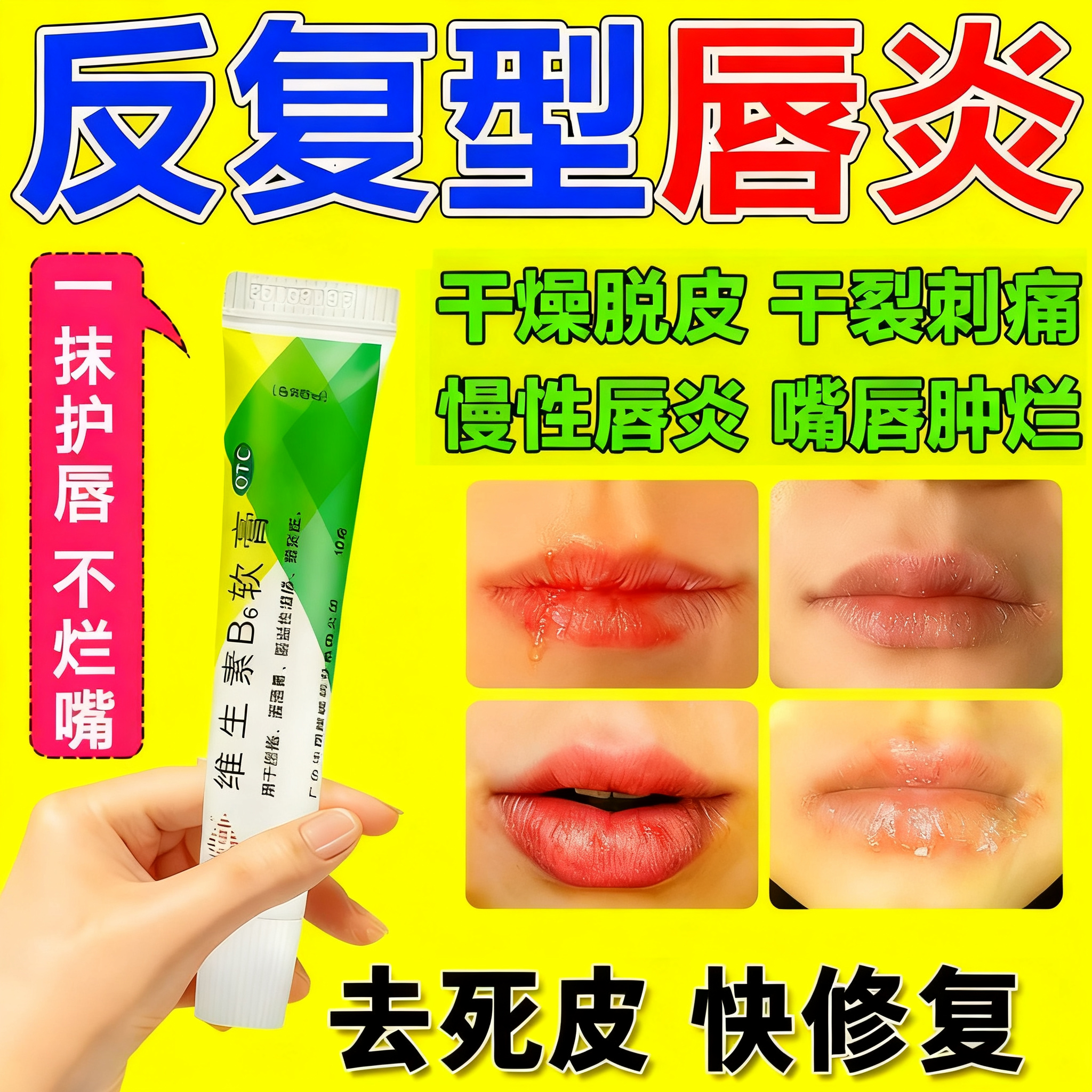 唇炎专用药膏
