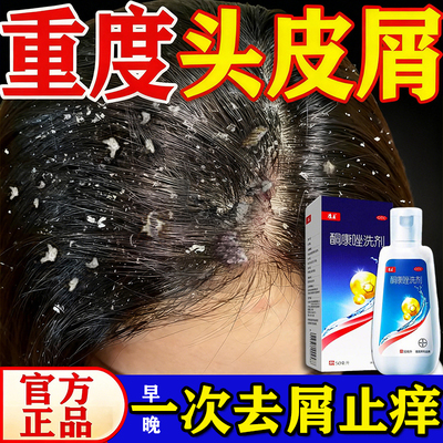 【康王】酮康唑洗剂2%*50ml*1瓶/盒