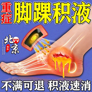 脚踝积液消除关节疼痛滑膜炎专用膏药热敷贴韧带损伤水肿崴脚恢复