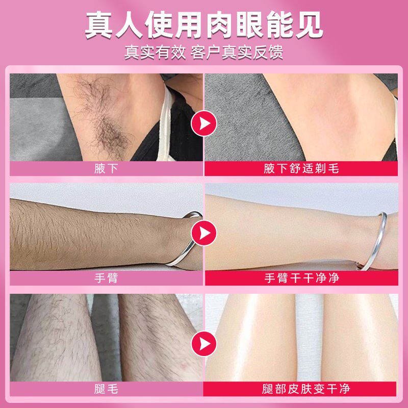 电动私处剃毛器刮毛刀男女士私密阴毛腋毛下腿毛脱毛机修剪仪