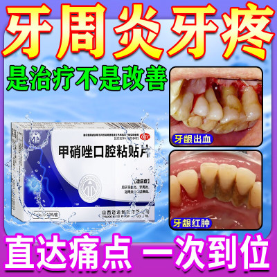 【迈迪】甲硝唑口腔粘贴片5mg*12片/盒