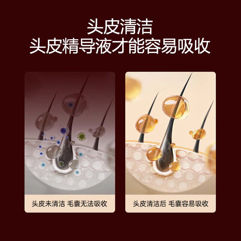 头皮按摩梳红光头部健发梳电动按摩器多功能精华液上药导入生发