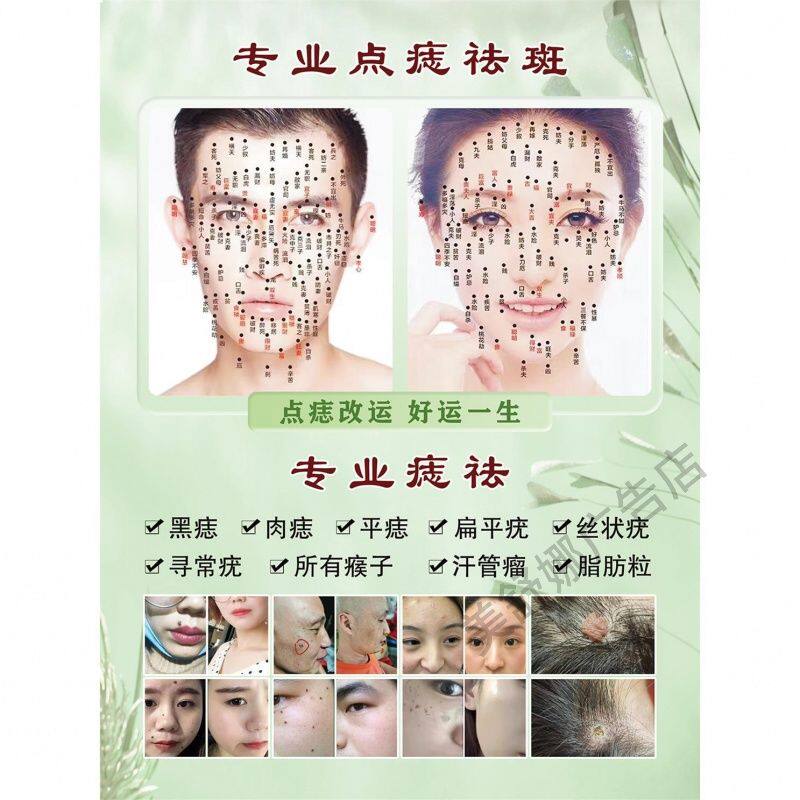 专业点痣宣传广告男女面痣图贴纸点痣广告图祛斑点疣去痣海报墙贴