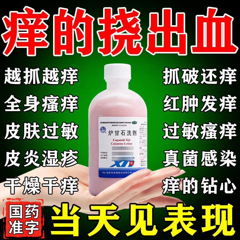 炉甘石洗剂外用湿疹止痒皮炎丘疹荨麻疹过敏止痒断皮肤瘙痒根抑菌