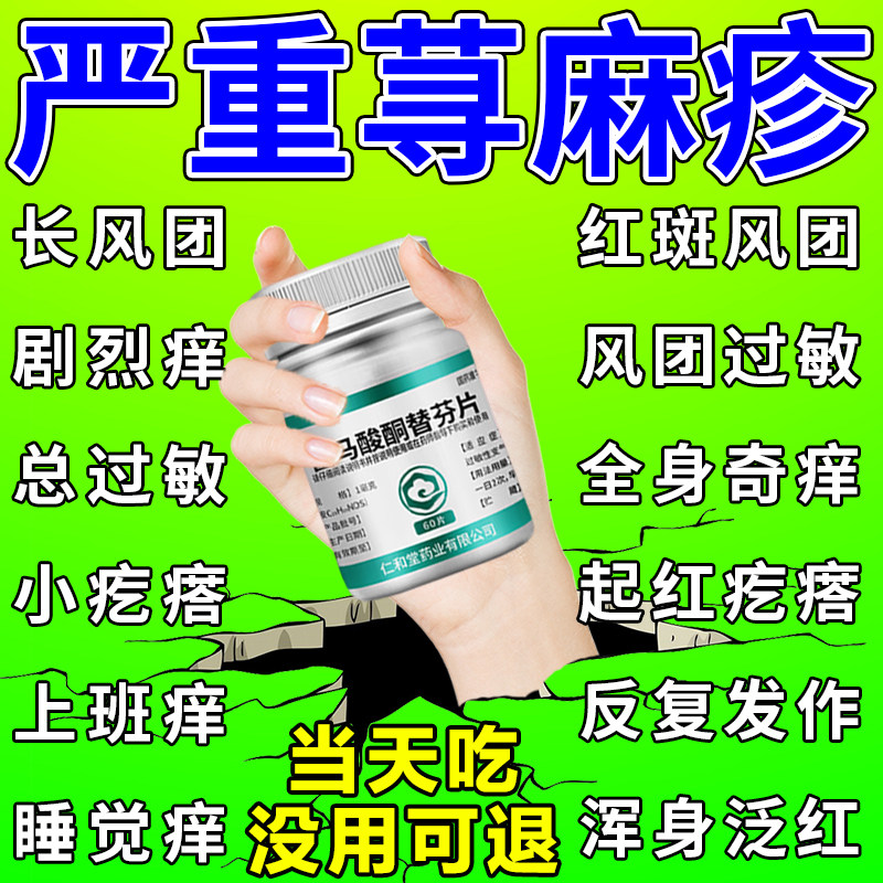 治疗荨麻疹皮肤过敏皮肤瘙痒断特痒止痒的药抗过敏药根口服药正品