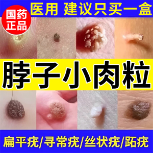 [尤维佳]维A酸乳膏0.1%*15g*1支/盒