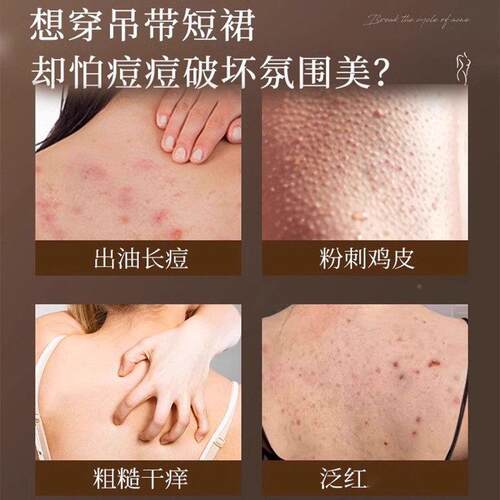 同仁堂硫磺洗除沐浴红露皮肤RUH痒螨祛后背痘疙硫磺皂洗澡瘩点手