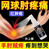 网球肘喷剂专用腱鞘健鞘炎手肘胳膊手腕大拇指肿大疼痛关节鼓包膏