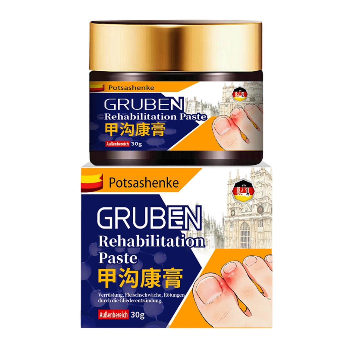 甲沟康膏30g/盒脚趾甲不适嵌甲矫正息肉肿痛甲肉分离养护外用护理