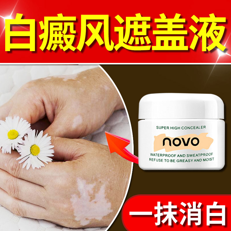 白癜风药膏快速消白斑专用外用皮肤遮盖液斑点遮瑕膏促进黑色素