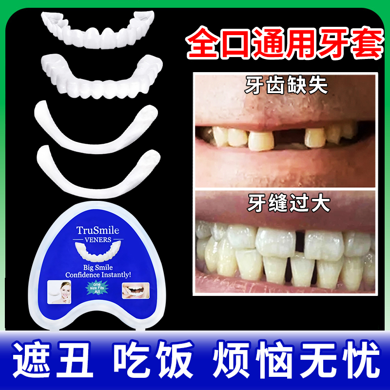 吃饭遮丑专用牙套全口通用