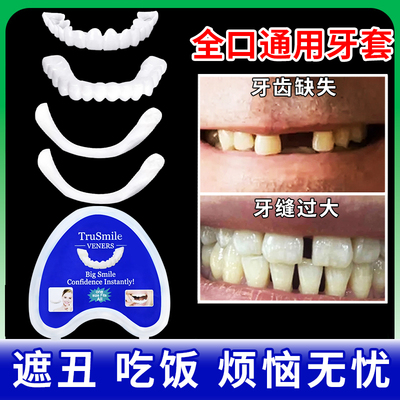 吃饭遮丑专用牙套全口通用