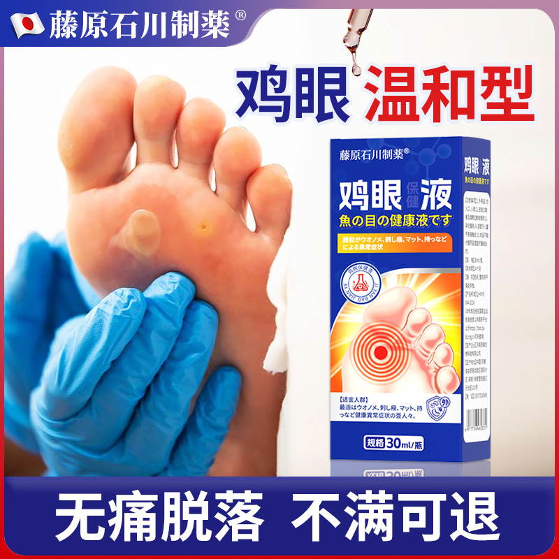 鸡眼药水脚钉祛除膏鸡茧眼严重脚底跖疣猴子除根软化液贴神器