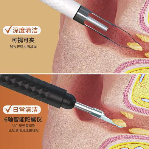 智能高清可视挖耳勺新款掏耳神器专业采耳工具带灯夹子儿童用发光