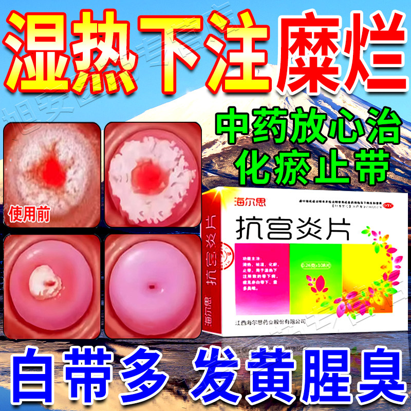 宫颈糜烂重度专用中药抗宫炎片中成药官方白带多湿热下注调理女