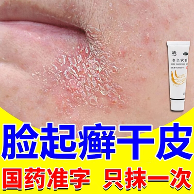 脸上干燥起皮脂溢性皮炎面部参皇软膏过敏皮肤修复脸部医用专用药