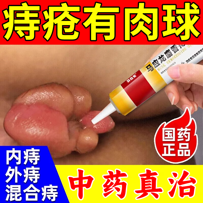痔疮特新效药马应龙痔疮膏正品官方旗舰店消痔软肉球女性大便出血