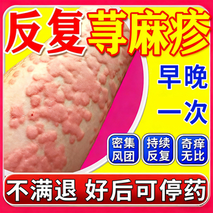 盐酸西替利嗪片旗舰店进口治疗荨麻疹过敏的特痒效口服药止痒用药