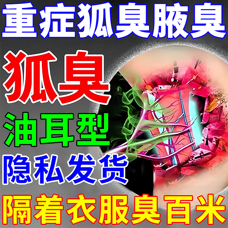 狐臭腋下除臭止汗喷雾男士去狐臭止汗露去异味西施兰乌洛托品溶液