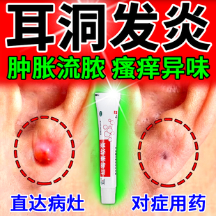 红霉素软膏外用官方旗舰店正品耳洞发炎专用药耳洞发炎清洁消炎毒
