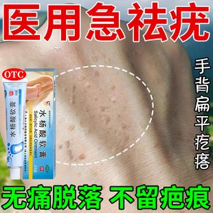 水杨酸去疣软膏正品丝状疣专用药去手背扁平疣特去除膏一抹灵效药