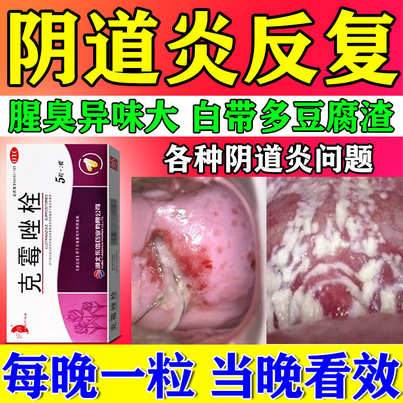 【白云山】克霉唑栓0.15g*10粒/盒