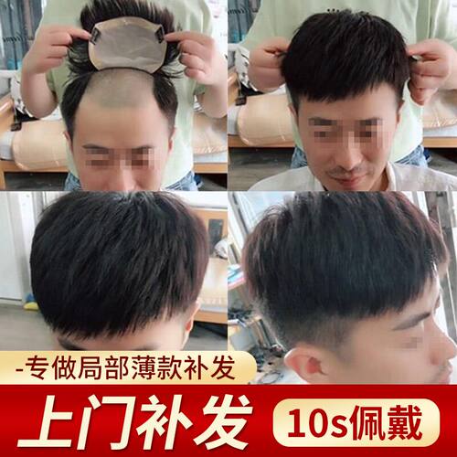 金极客补发假发男短发头顶发片超薄真发J韩版帅气隐形发际线补发