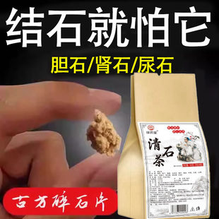 排石茶 金钱草中草药肾结石专用鸡内金化石草药排石颗粒克星正品