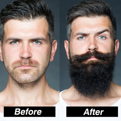 极速4Pcs/Set Beard Growth Kit MeCn Hair Enhancer Thicker Set