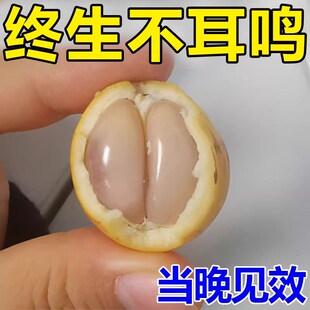 买3送2 买2送1 耳不鸣耳不嗡 活动进行 已成功冶愈65万人耳鸣