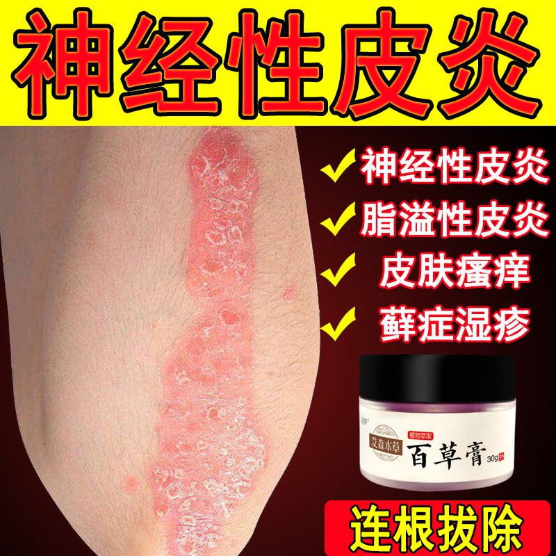 艾森本草百草膏紫花地丁神经性皮肤牛皮银屑皮肤瘙痒止痒膏全身用