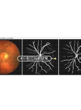 Python医学图像分割（眼底血管分割）