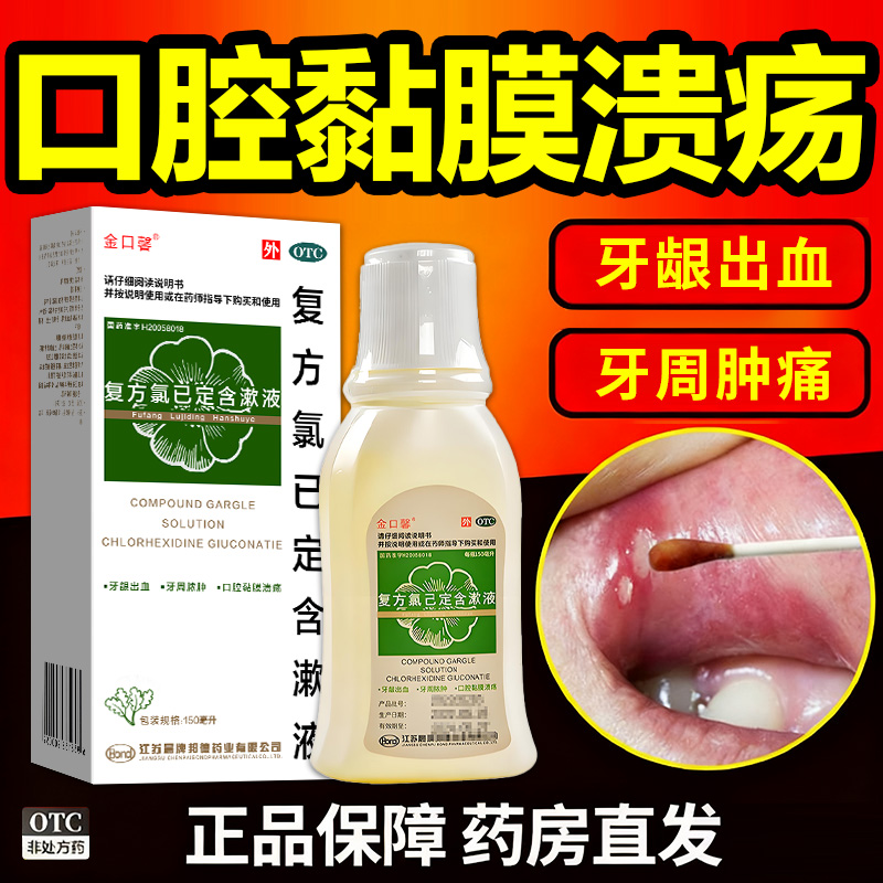 【中大】复方氯己定含漱液150ml*1瓶/盒反复口腔溃疡专用药治疗含漱液漱口水
